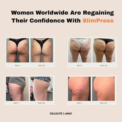 SlimPress™ Cellulite Massager